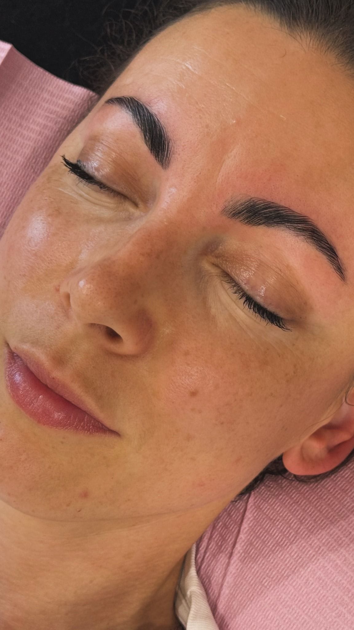 Frisch gestylte, definierte Augenbrauen nach einem Browlifting